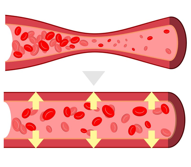 血管の拡張