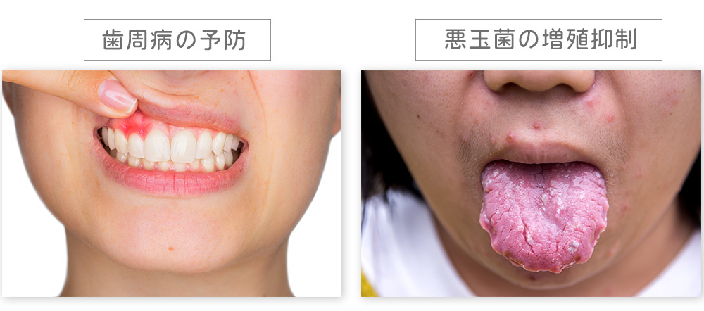 「歯周病の予防」「悪玉菌の増殖抑制」する２つの乳酸菌